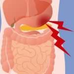 What Causes Abdominal Pain?